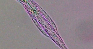 New DNA Modification System Discovered in Animals – Captured From Bacteria More Than 60 Million Years Ago