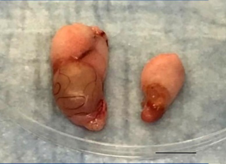 COVID-19 Virus Can Cause Severe Testicular Damage – Possible Low Sex Drive and Infertility