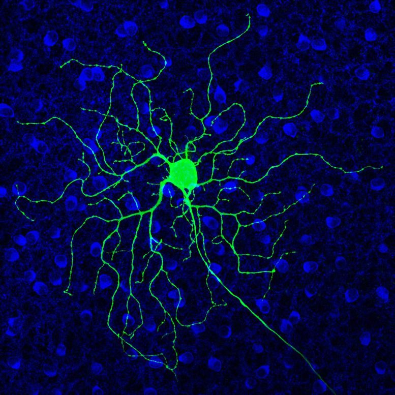 FDA-Approved Drug May Help Revive Vision in People With Progressive Blinding Disorders