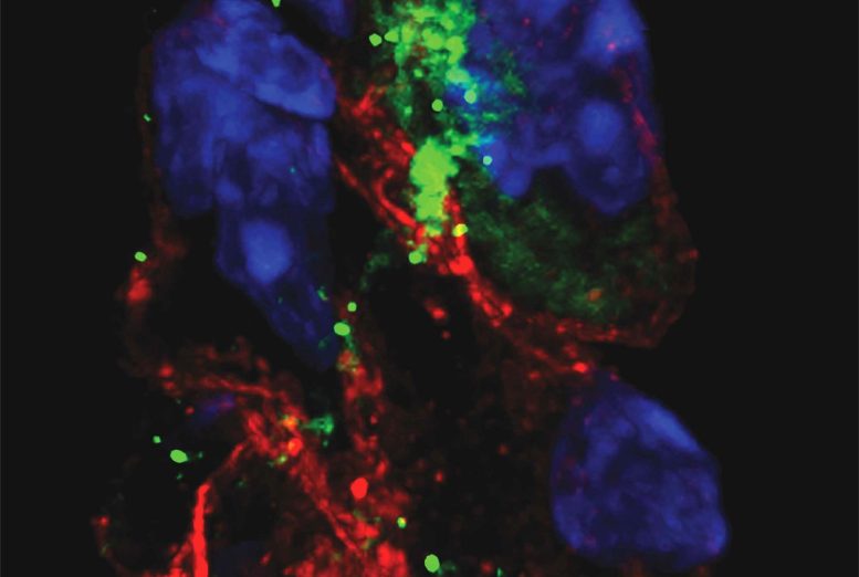 COVID Can Infect Pacemaker Cells That Maintain the Heart’s Rhythm, Setting Off a Self-Destruction Process
