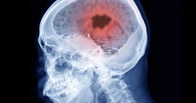 Independent Studies Find Elevated Risk of Blood Clots in the Brain Following AstraZeneca COVID-19 Vaccination